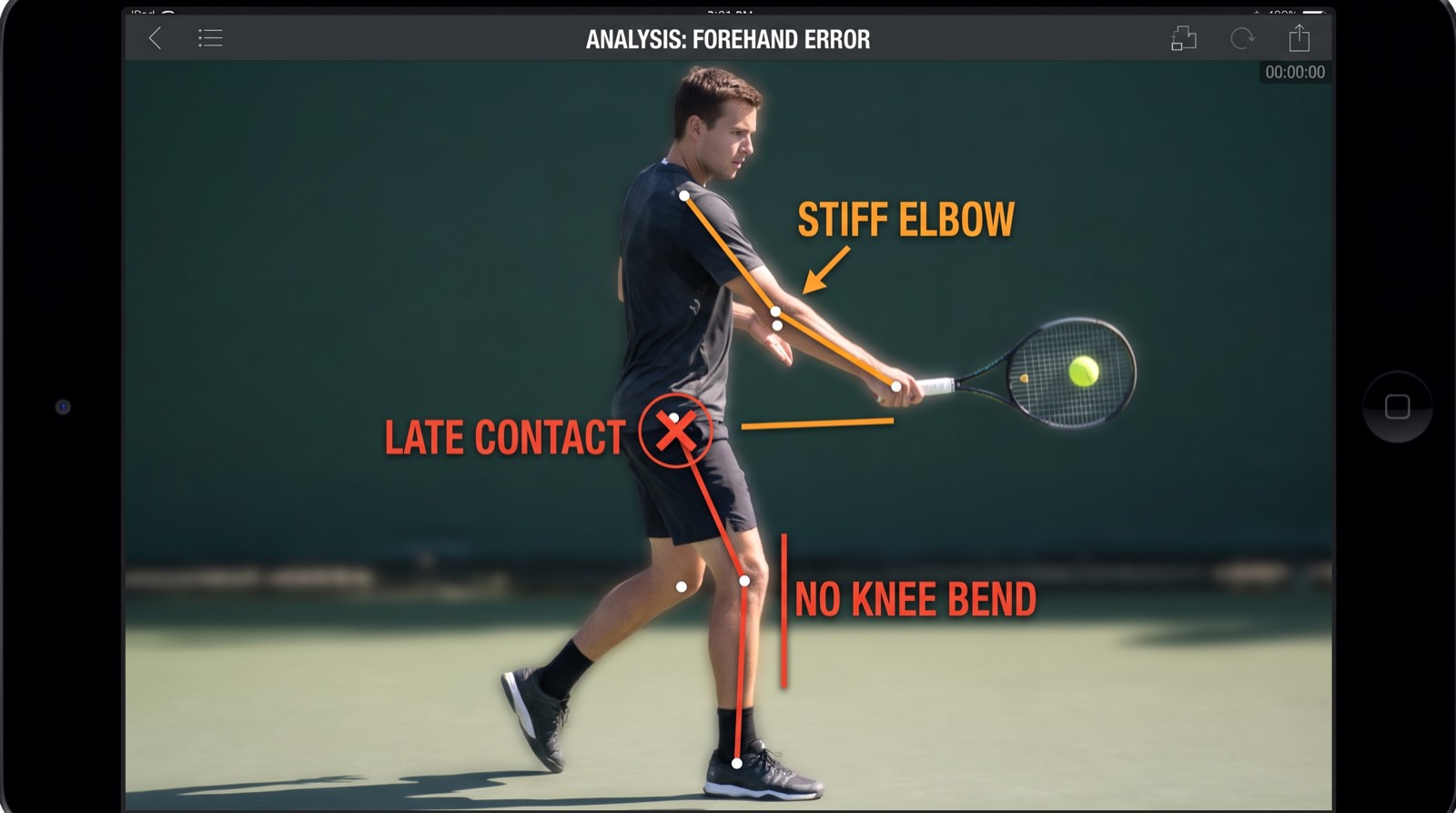 Movement analysis — common errors: stiff elbow, late contact, no knee bend